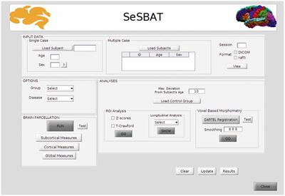 SeSBAT: Single Subject Brain Analysis Toolbox. Application to Huntington’s Disease as a Preliminary Study